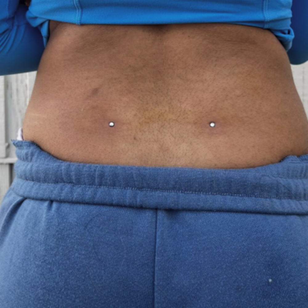 TWO DERMALS at DeAna’s Diamonds in Green cove springs, FL