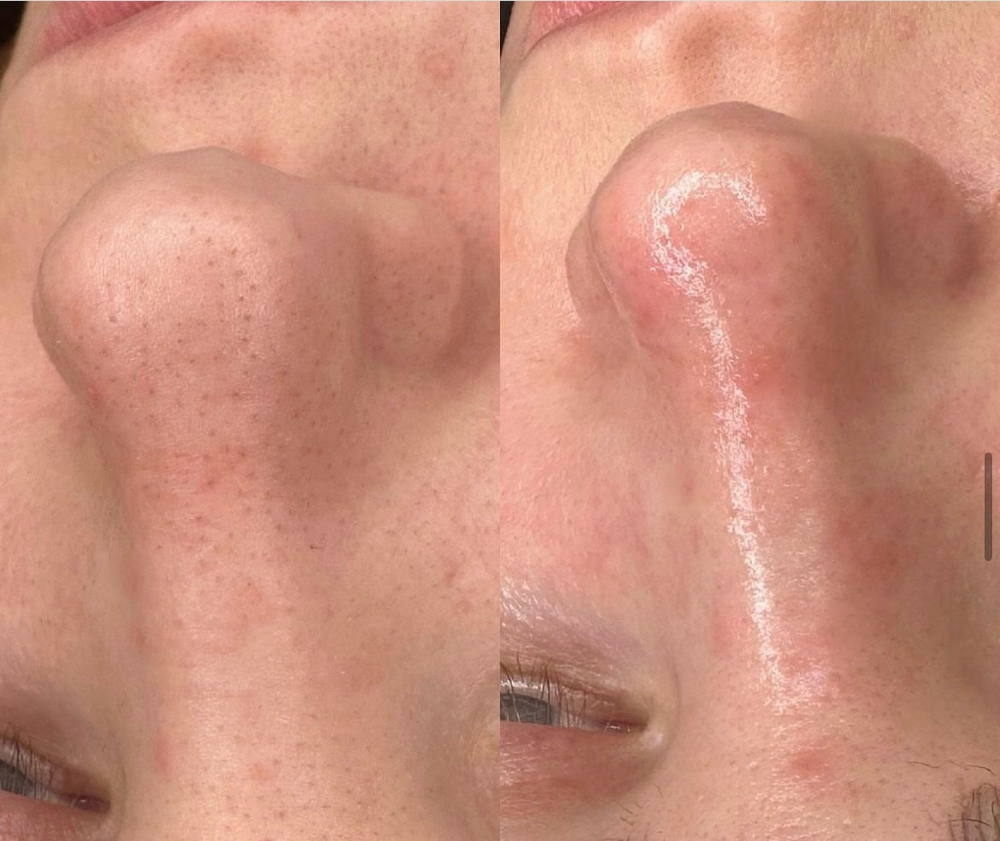 Custom Facial