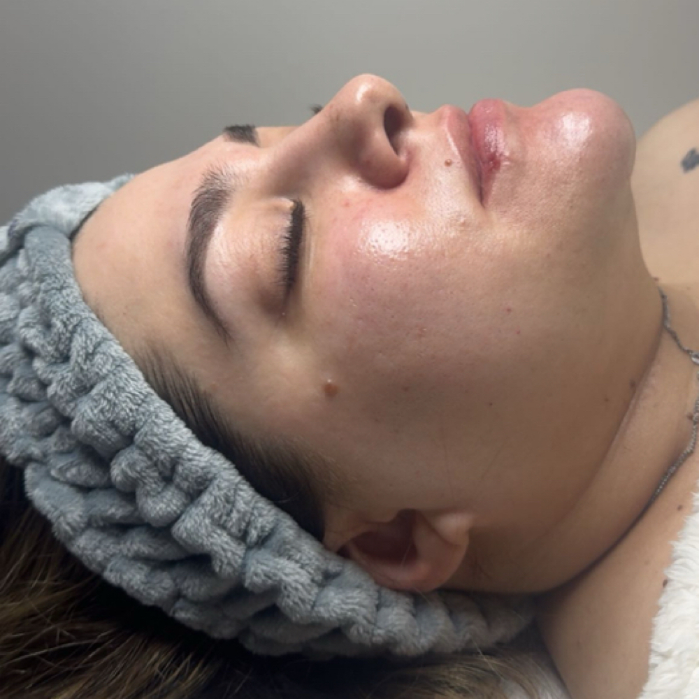 Clarity Facial + Chemical Peel at Divine Esthetics By Camille in San Antonio, TX