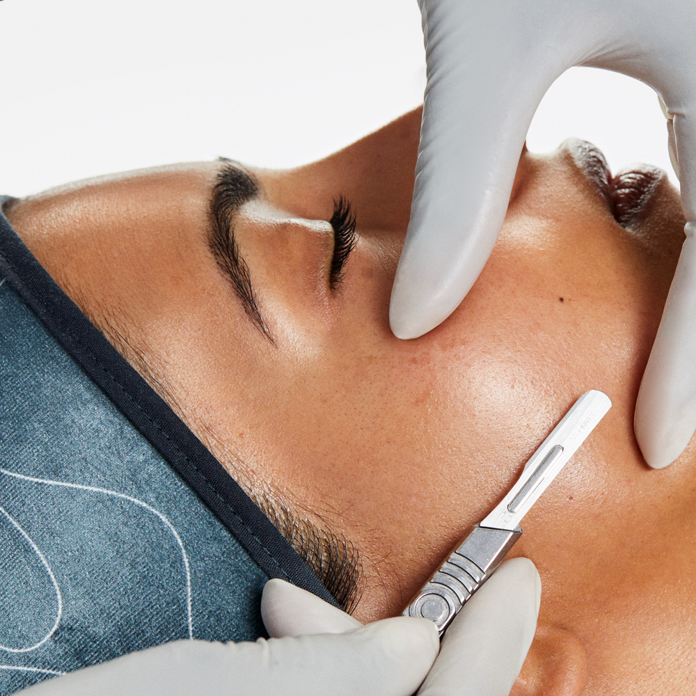 DermaplanIng Facial