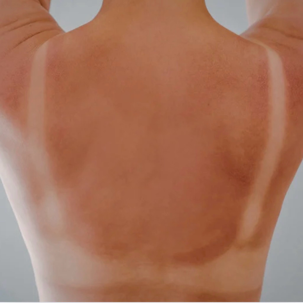 Tan Line Blending at Lori Bell Sunless in Amarillo, TX