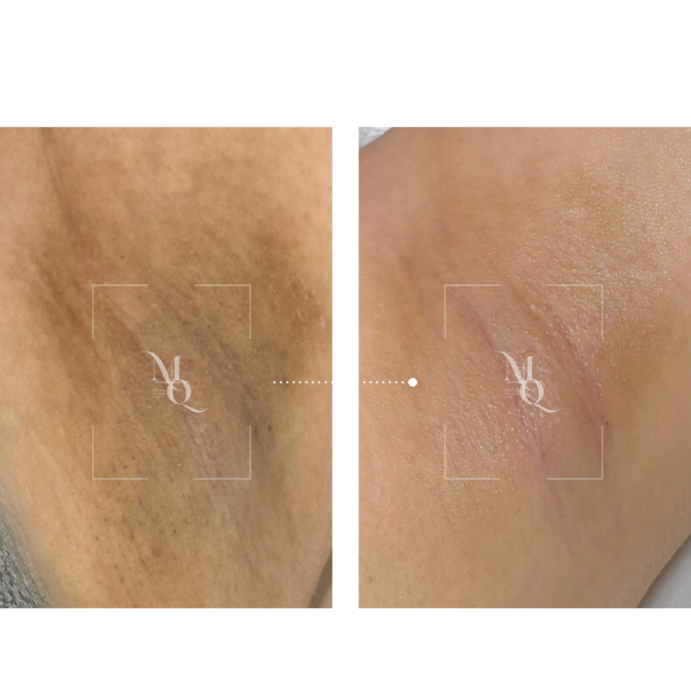 Intimate Melanin Care at Ink Beauty Studio in McAllen, TX
