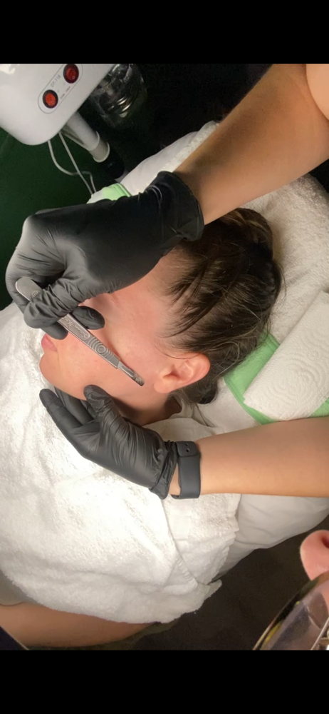 Dermaplane Facial