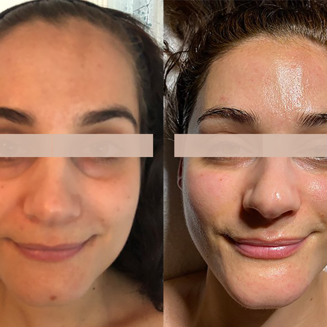 The Works at Ingrid Thompson Skincare in Beverly Hills, CA