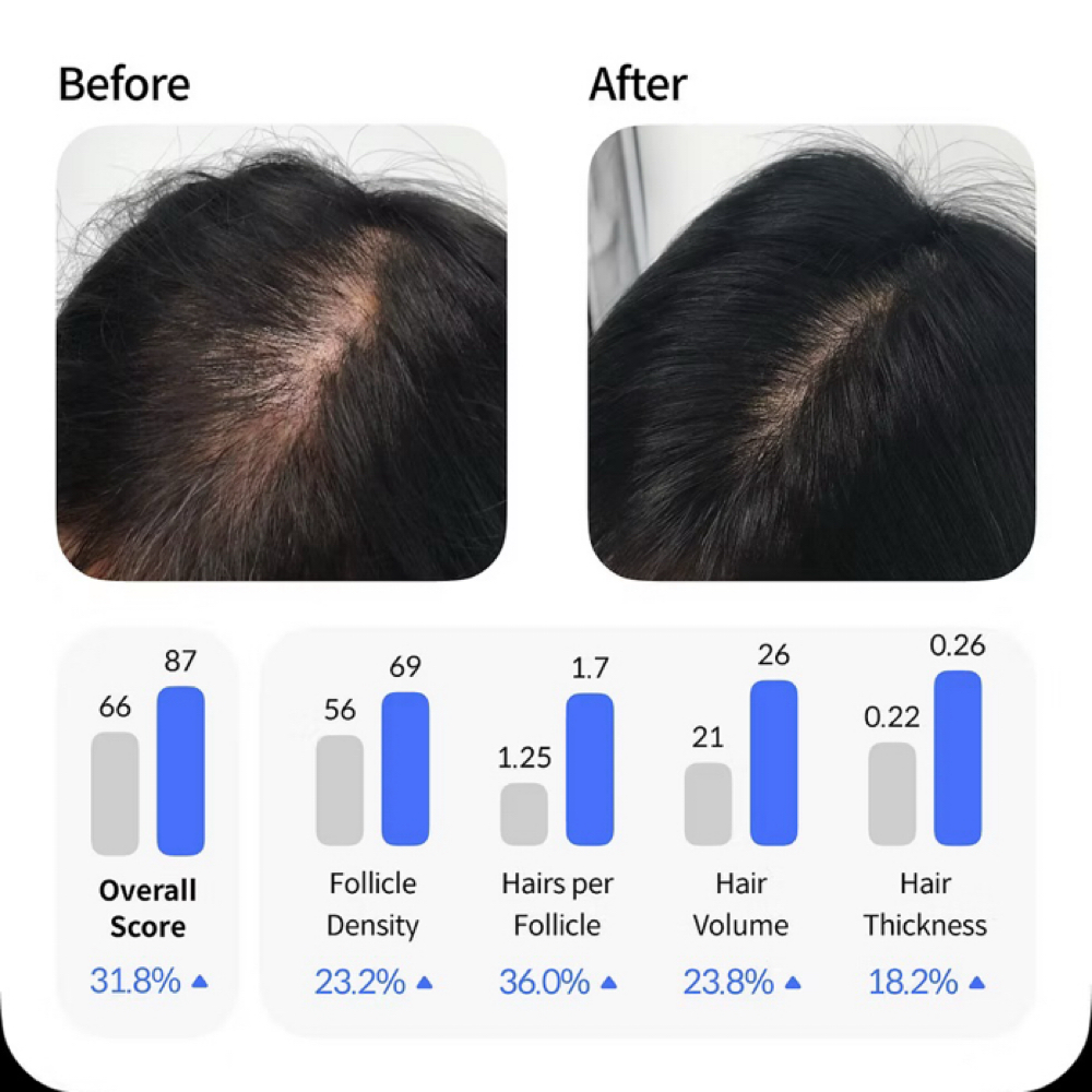 Hair Restoration Program Follow-Up at Skin + Halo in Hartland, MI