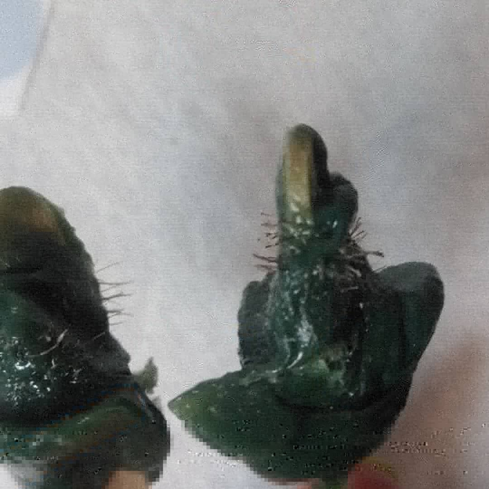 Ear Wax