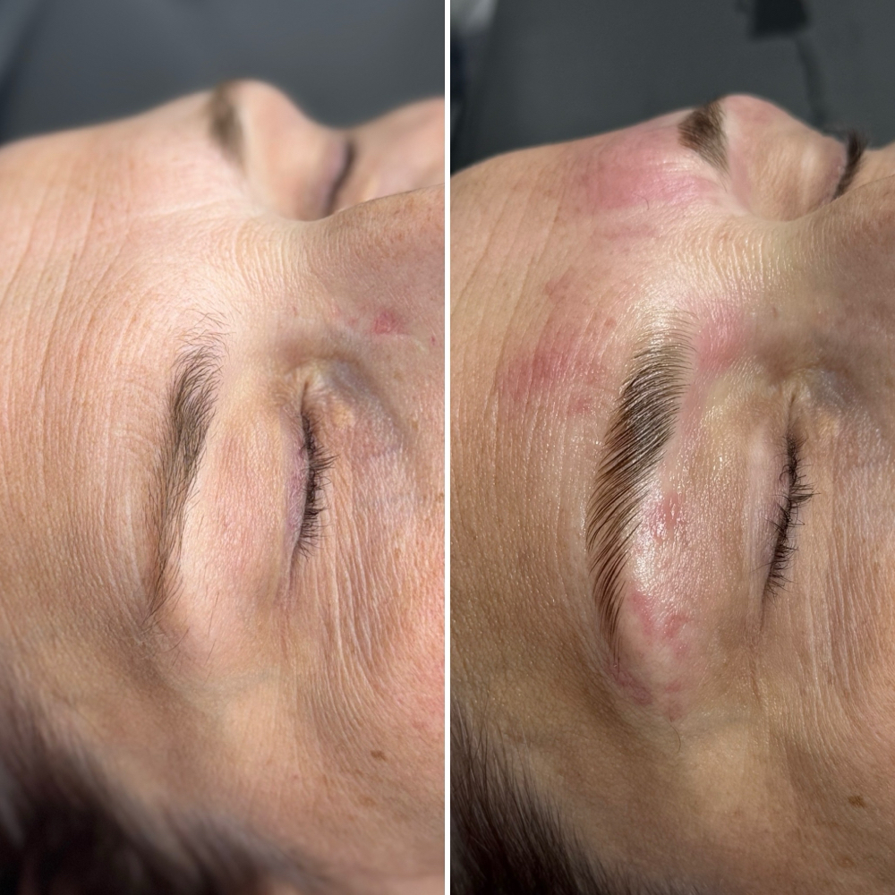 Brow Lamination (Models)