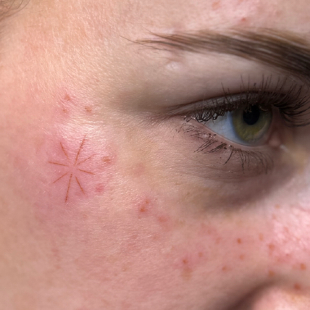 Freckles at Birdhouse Cosmetic Tattooing in Fairbanks, AK