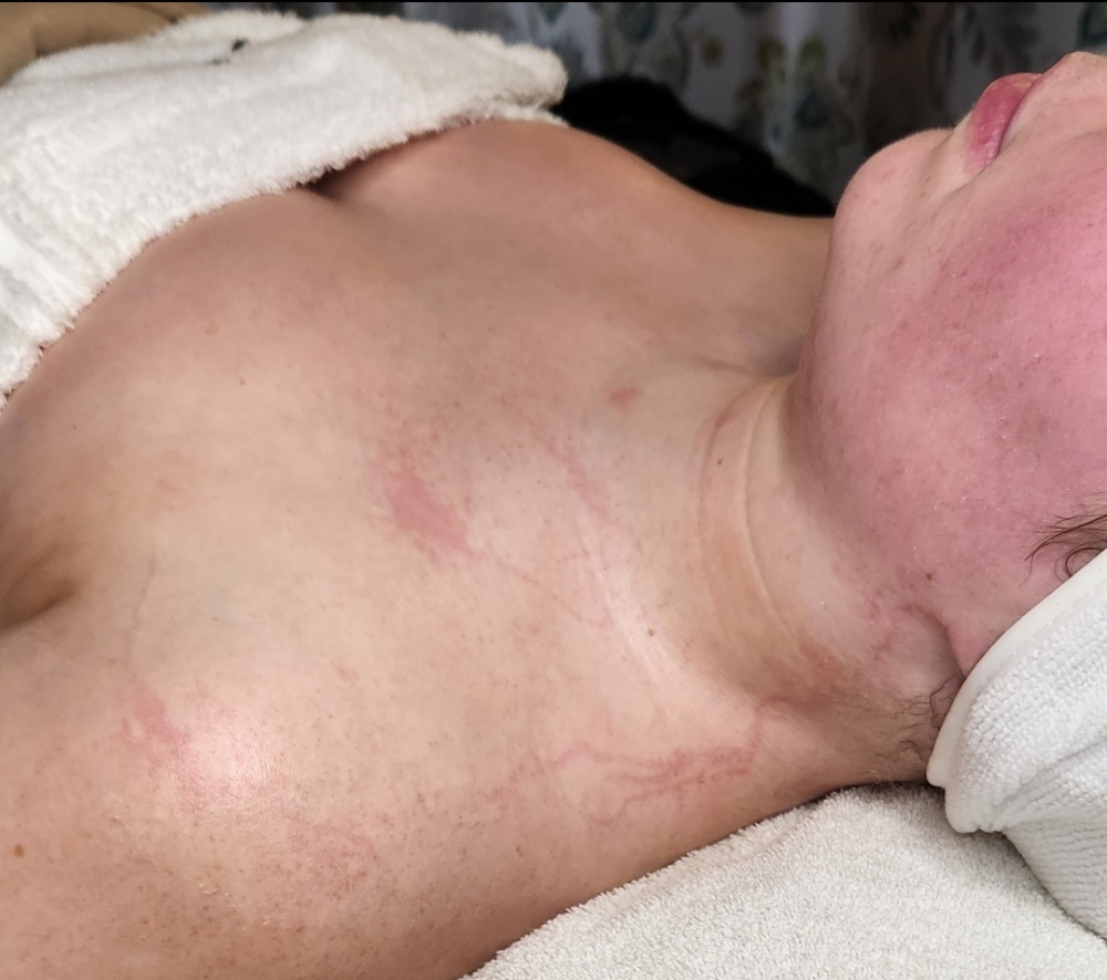 Skin Bar Enzyme Therapy