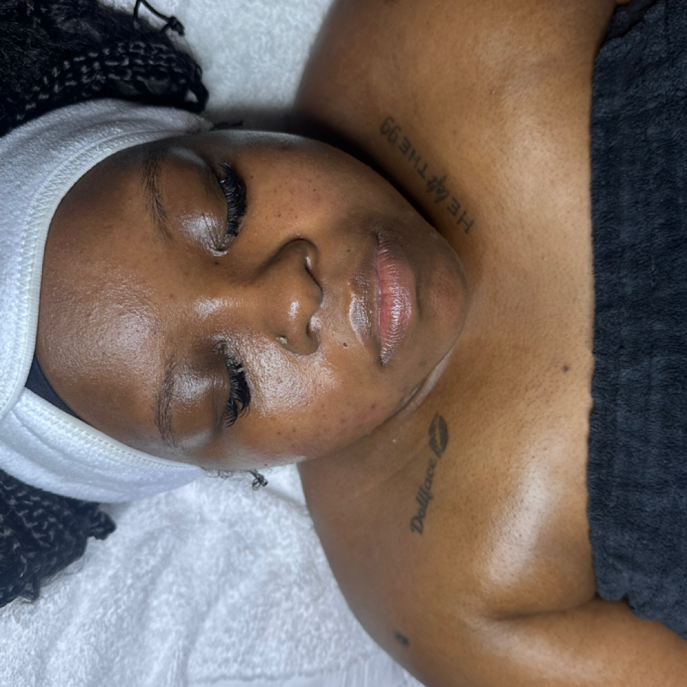 The Pro Peel Treatment at The Beauty Bank in Oklahoma City, OK