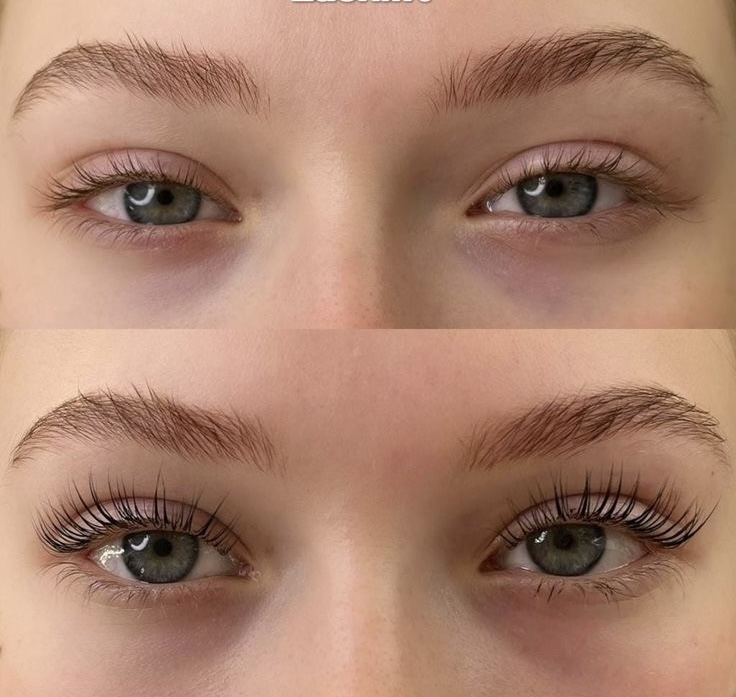 Lash Lift