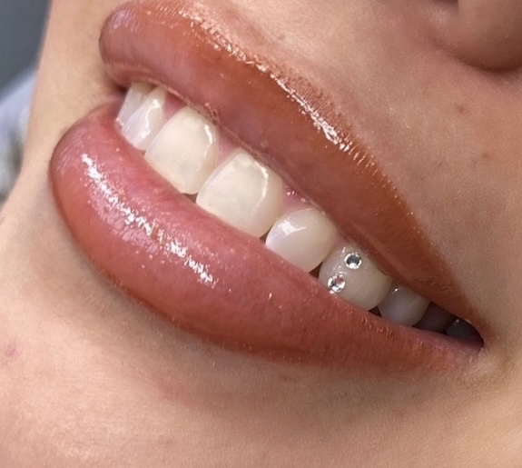 Double Swarovski Tooth Gems