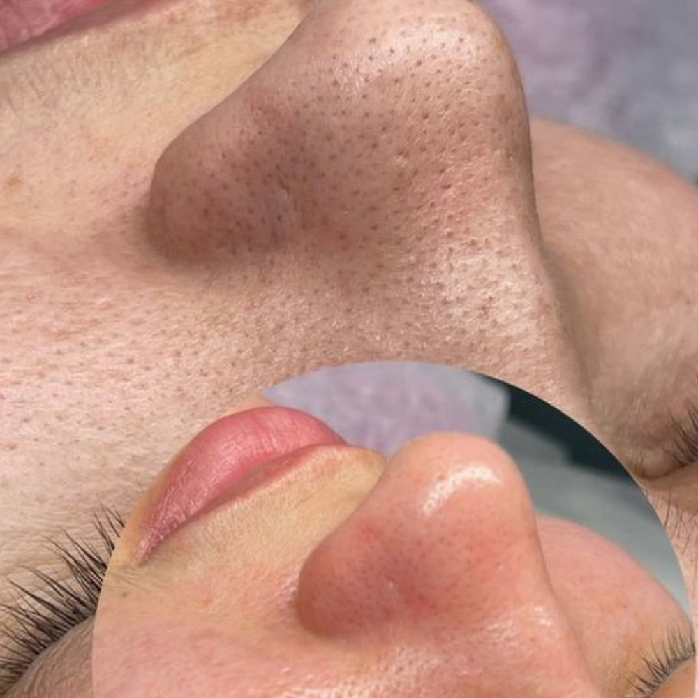 Customized Facial Deluxe at Coquette Esthetics Salon in Hurst, TX