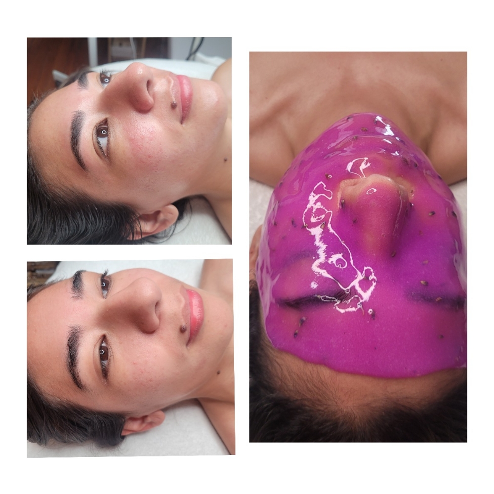 Custom Facial+Physical Exfoliation