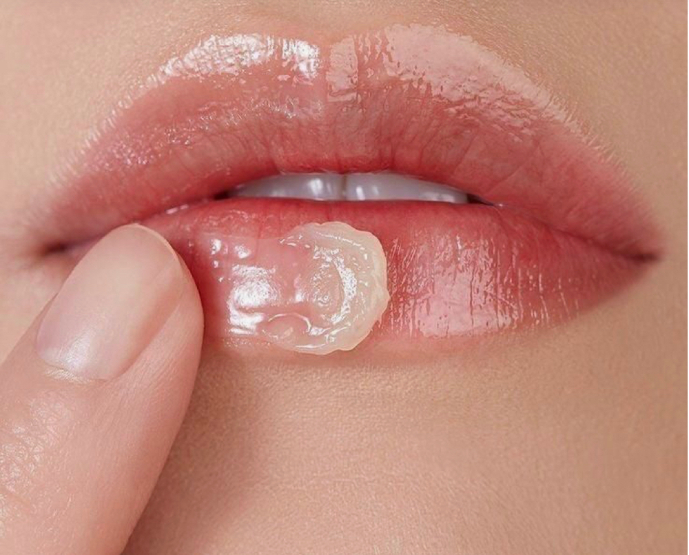 Add On Lip Treatment