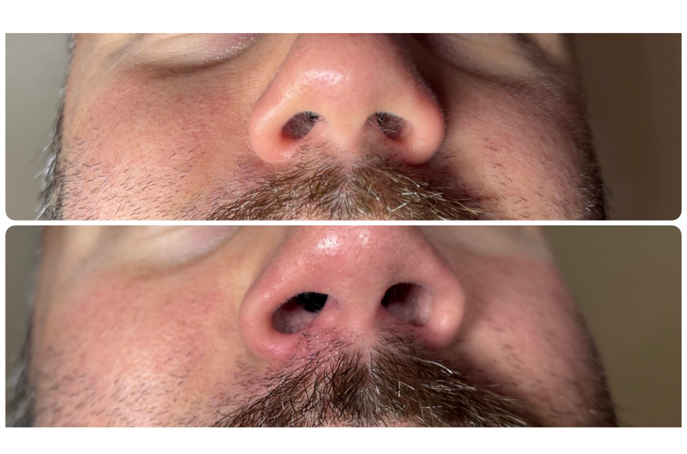 Nose Wax at Shear Energy LLC in Loganville, GA