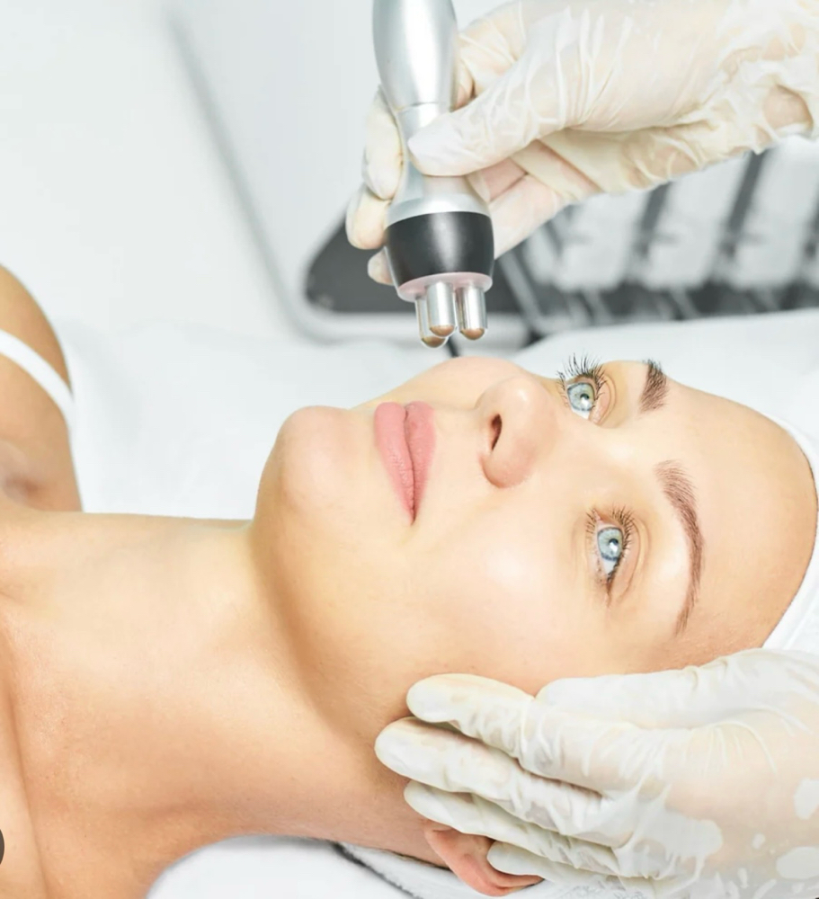 RF Facial &/or Chin Sculpting