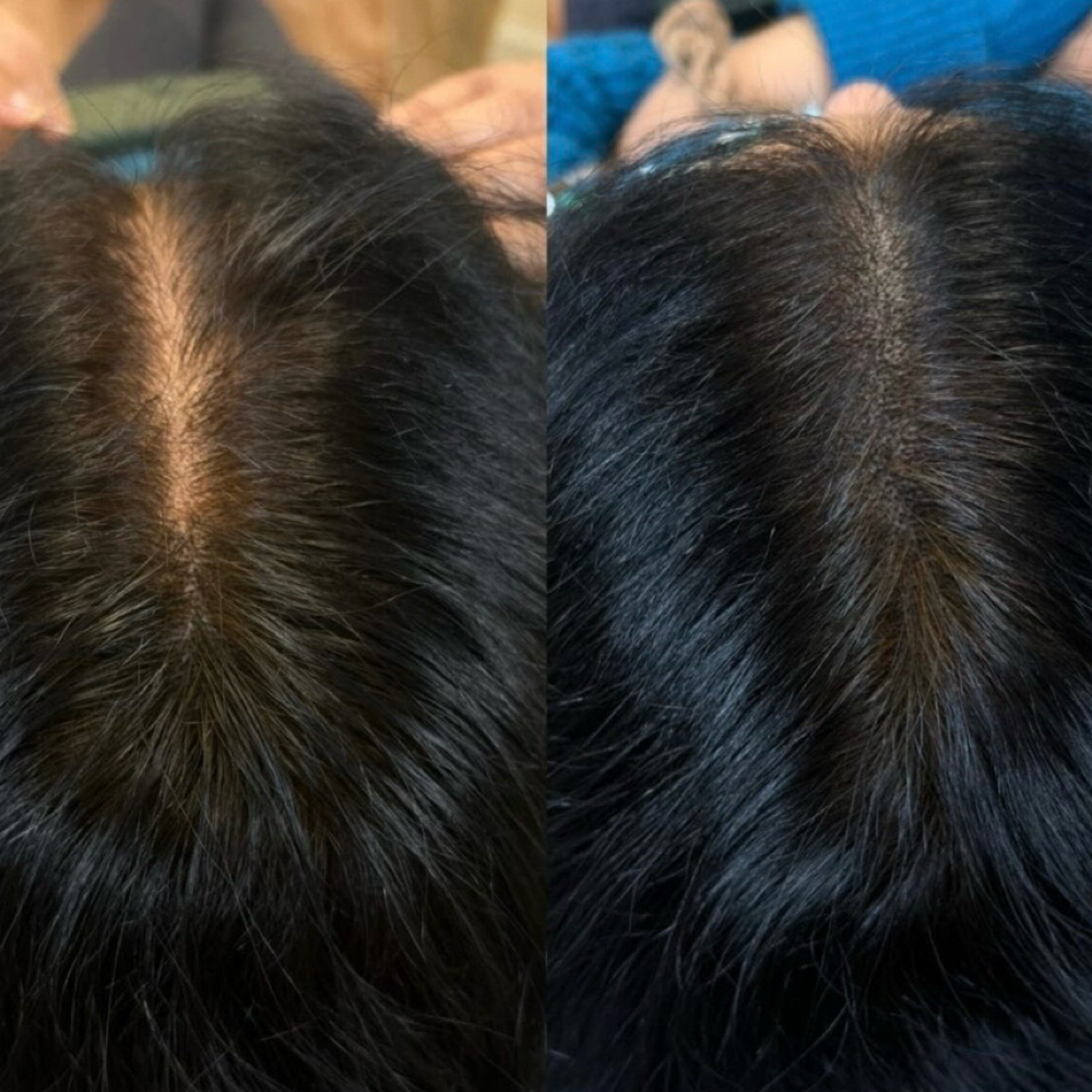 SCALP MICROPIGMENTATION at GLAM STARR in Roswell, GA