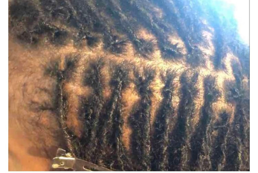 Microlock Starter Locs Grid