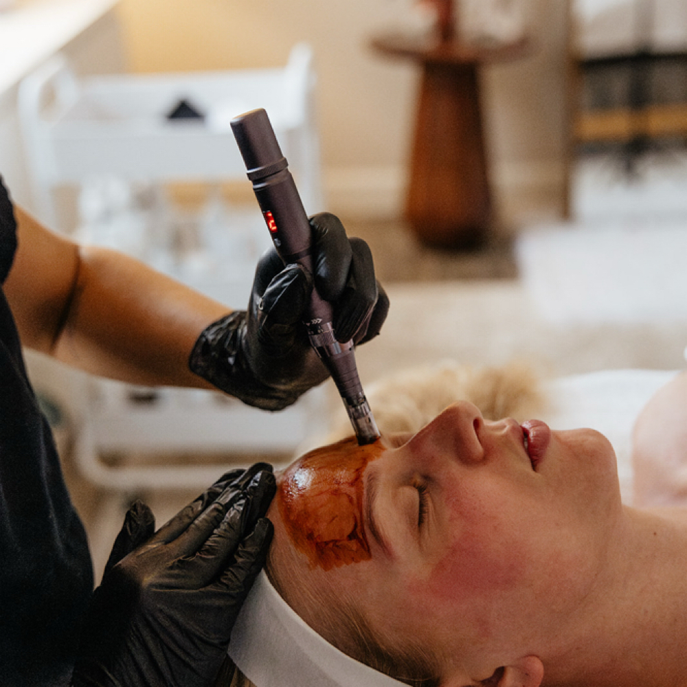 Revitapen Infusion Facial