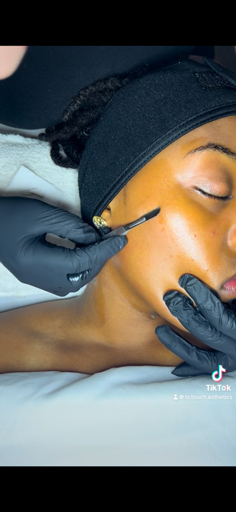 Dermaplaning (Add On To Any Facial)