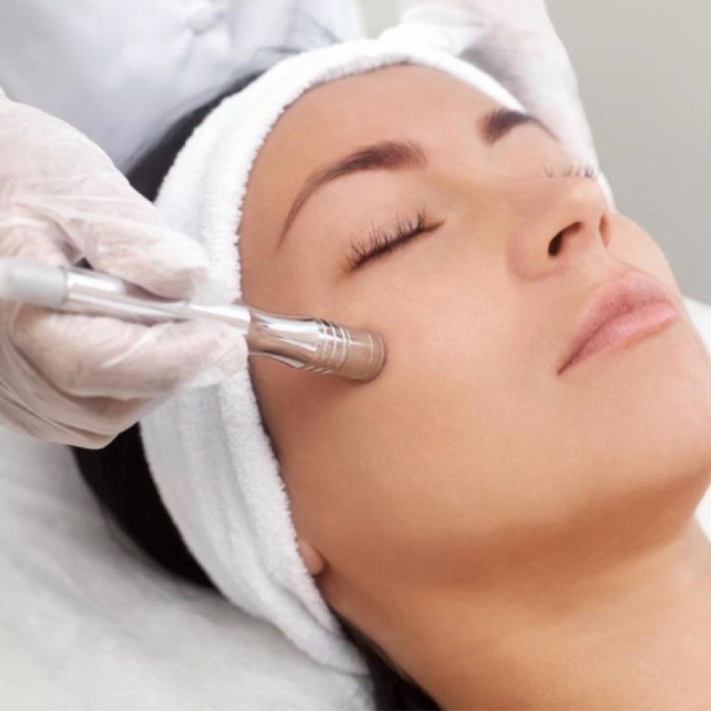 Microdermabrasion (Add on) at Centered Aesthetics LLC in Fullerton, CA