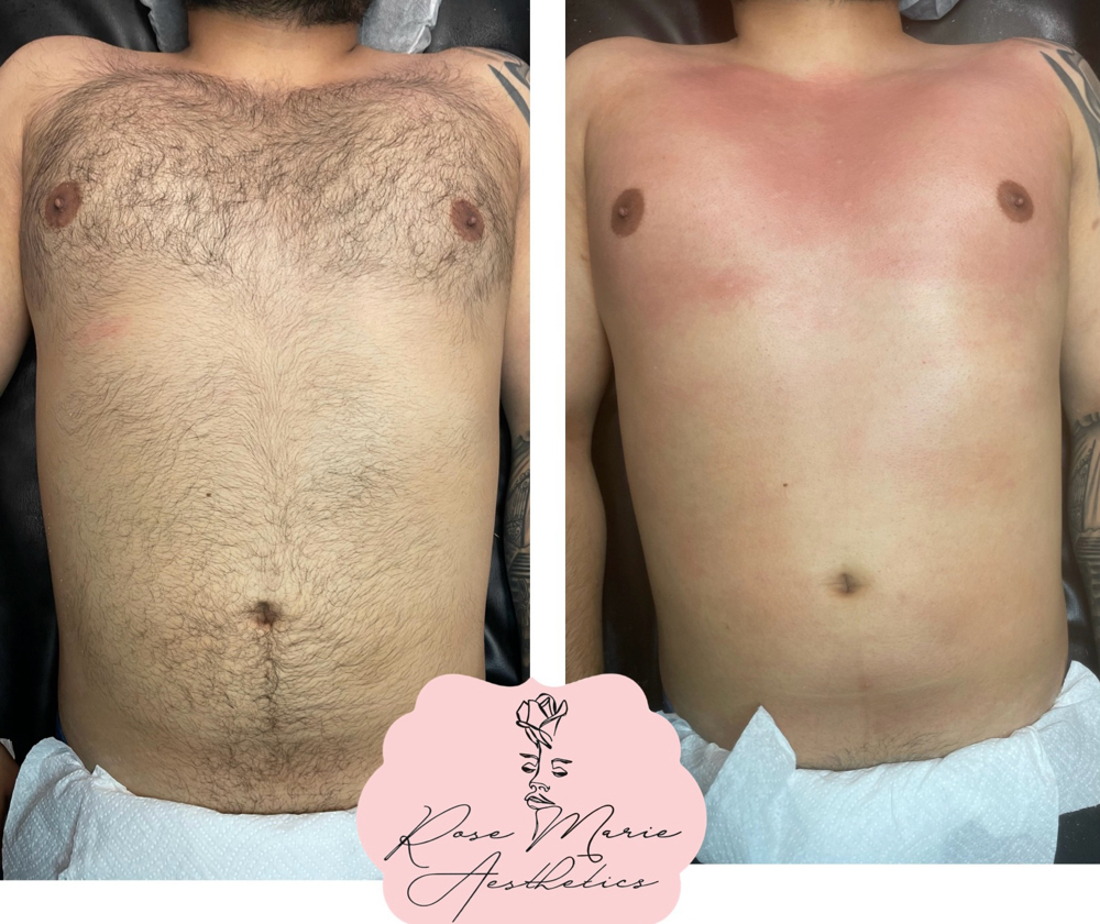 Mens Chest Wax