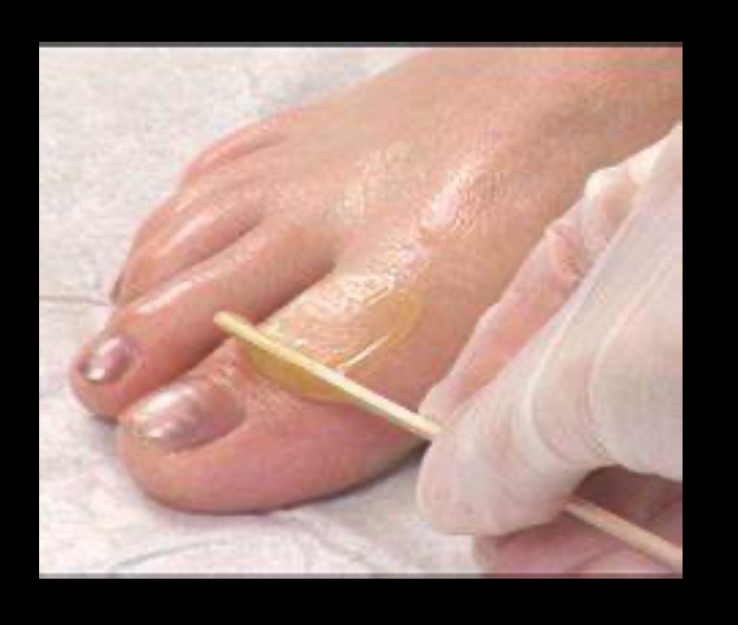 Toe Waxing at Qs Nail Den in Fredericksburg Va, VA