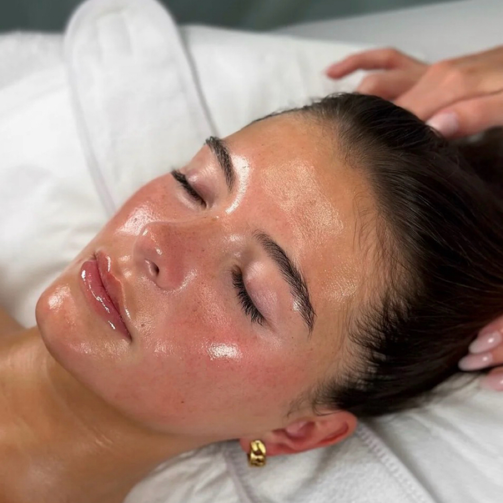 Collagen Induction Therapy at V Glow Miami in Miami Beach, FL