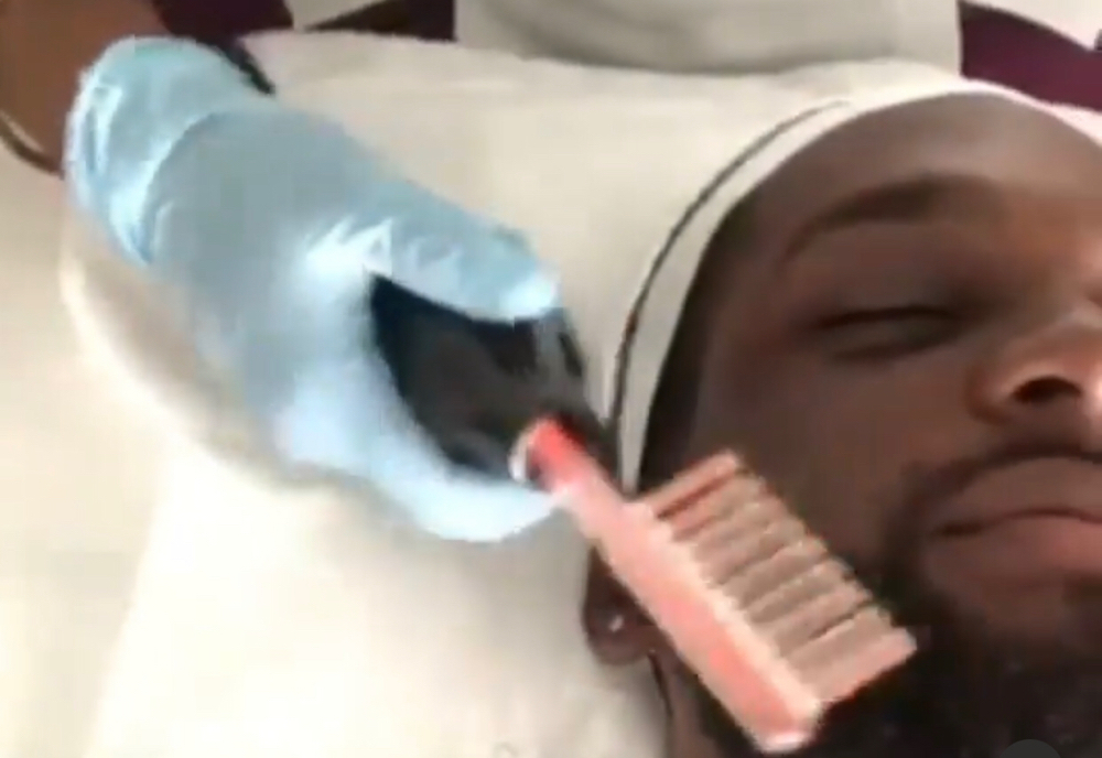 Best Beard Treatment