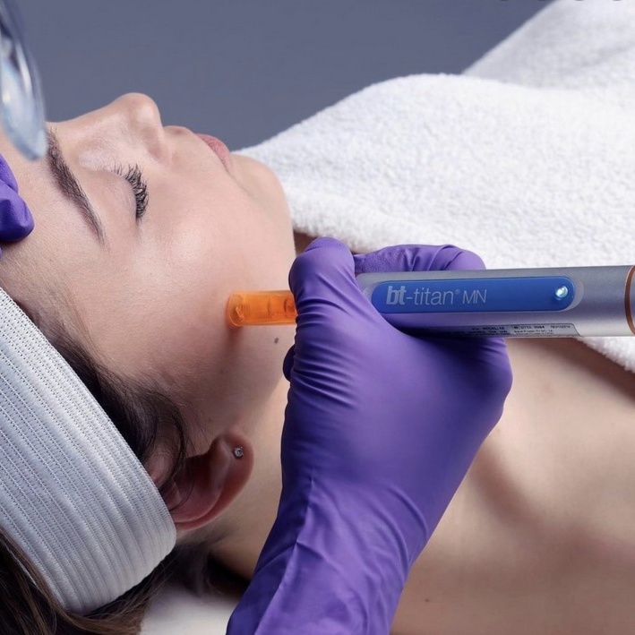 NANO INFUSION FACIAL at Bellissimo Esthetics in Billings, MT