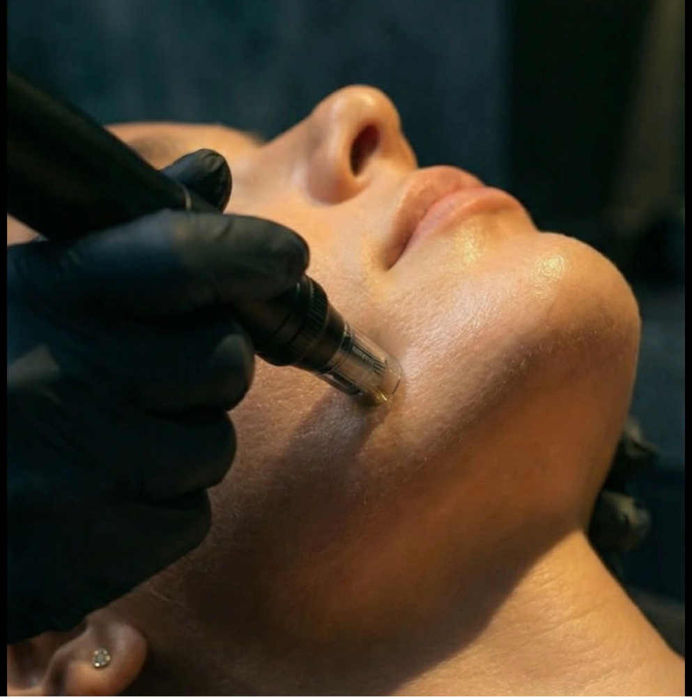 Micro-Needling Consultation at L. Esthetics Skincare At Cheveux Salon in Marshfield, WI