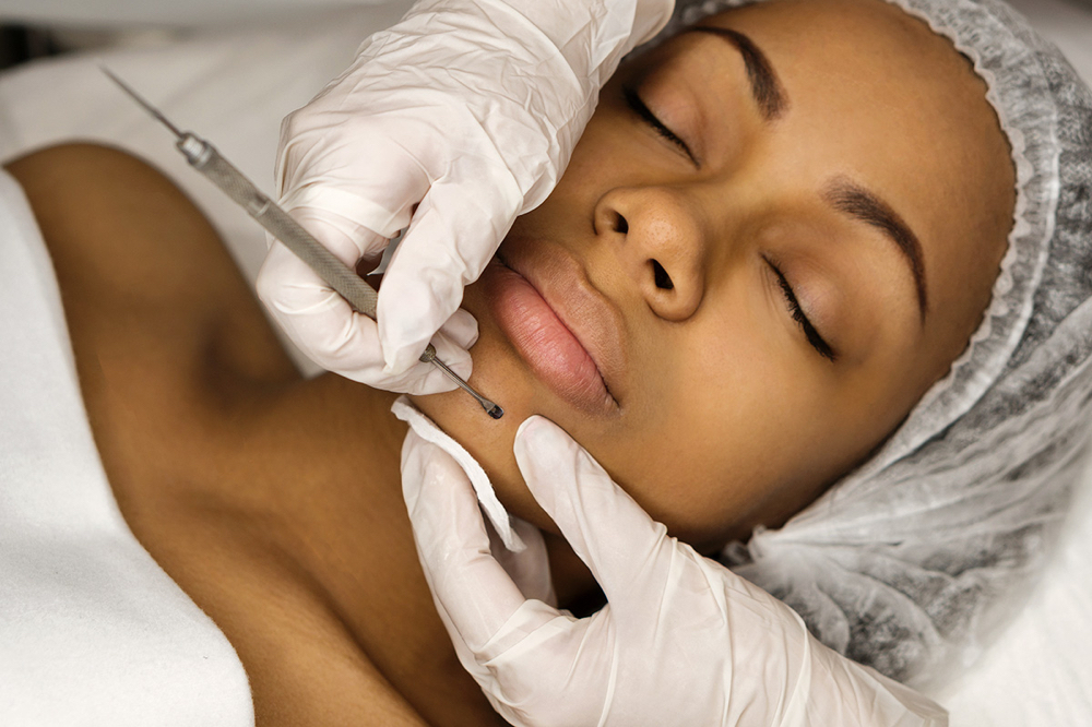 Demi Facial