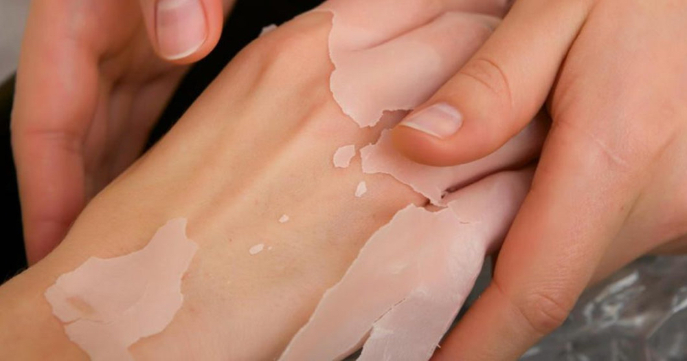 Parafin Hand Treatment