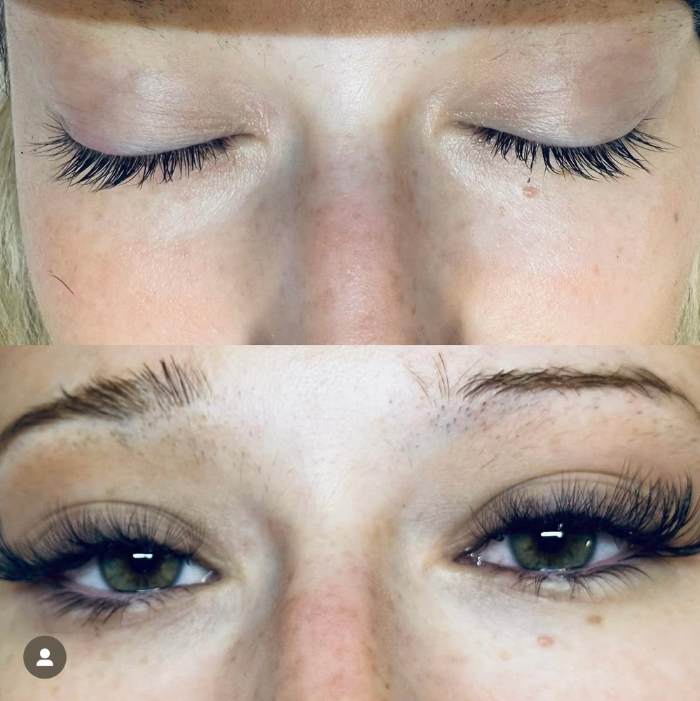 Hybrid Lash Set