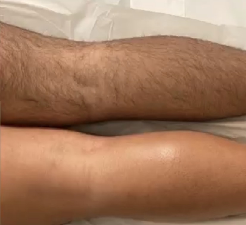 Full Leg Wax at Unveiled skin in Moreno Valley, CA