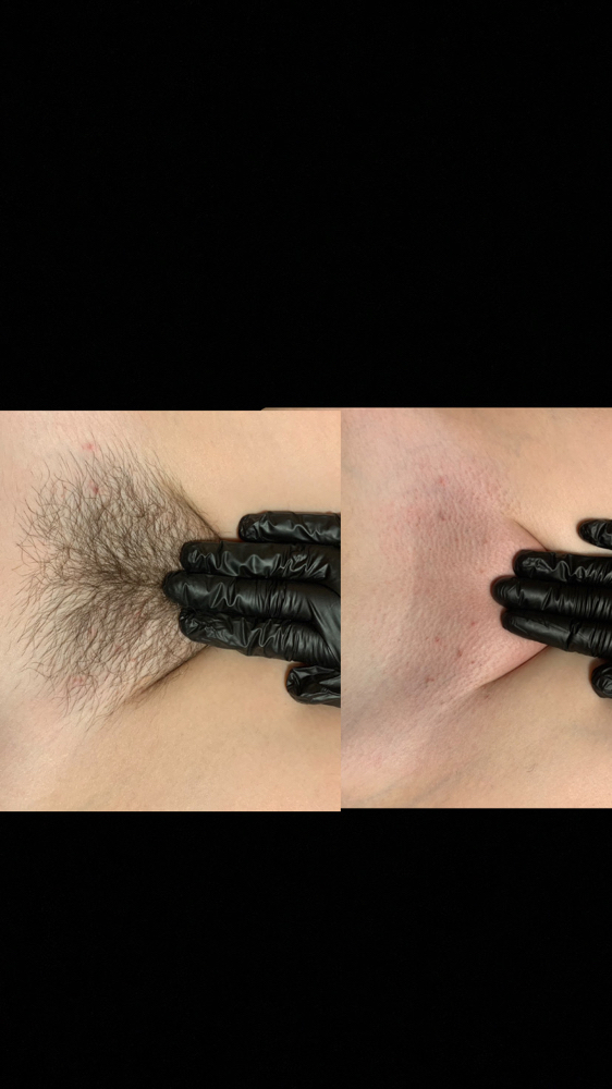 Brazilian at Karisbeautyroom in Hillsboro, TX