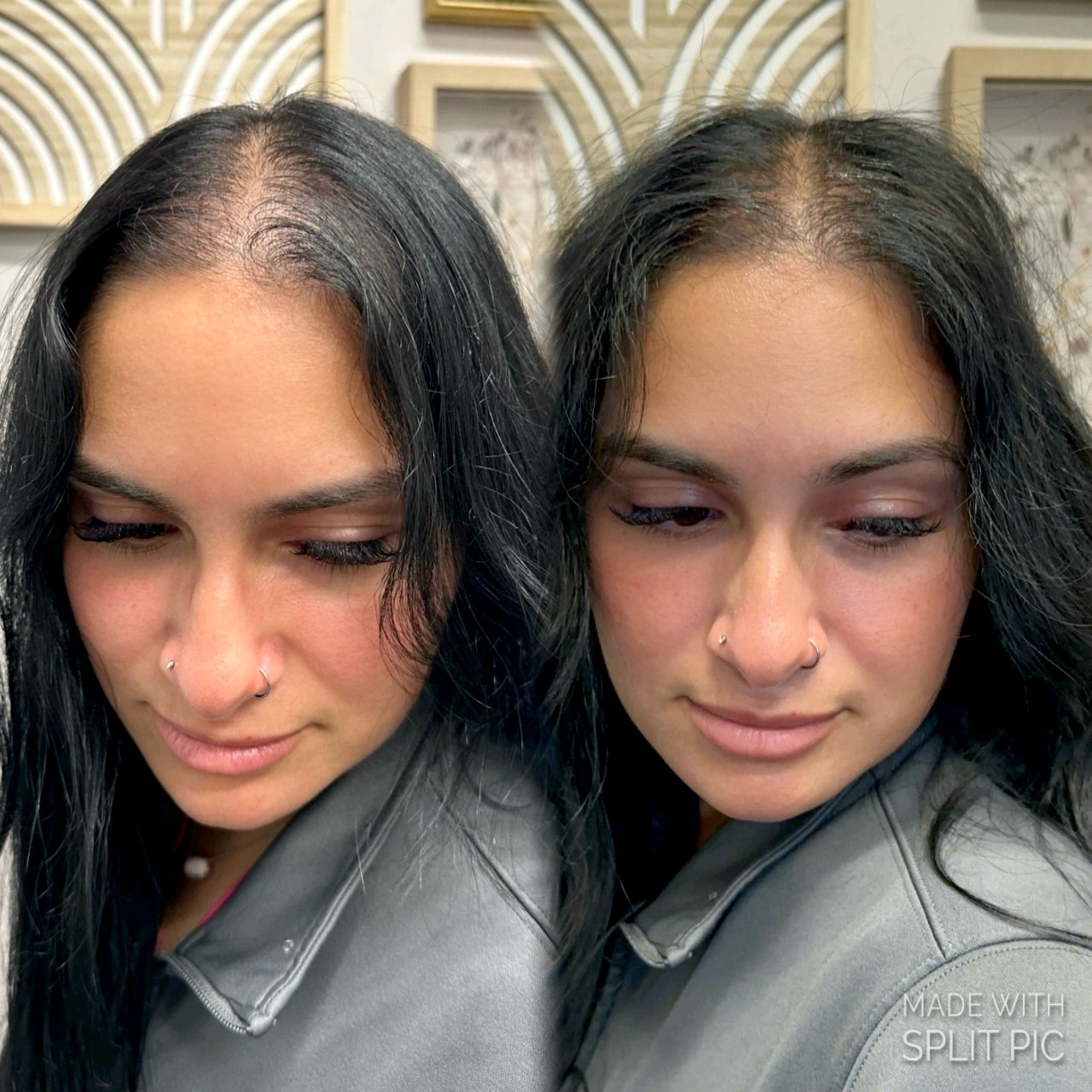 Hair Restoration Consultation at Lilian Lofton Hair in New Orleans, LA