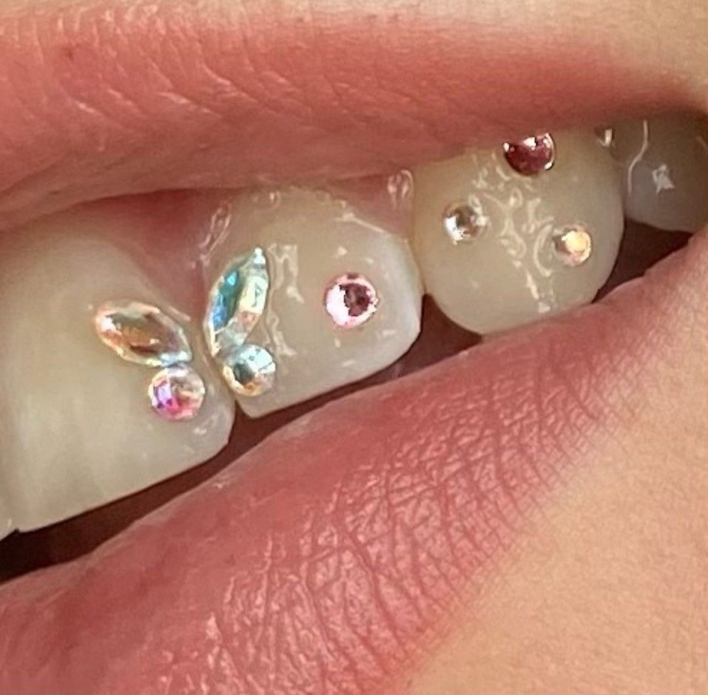 Freestyle Teeth Gems