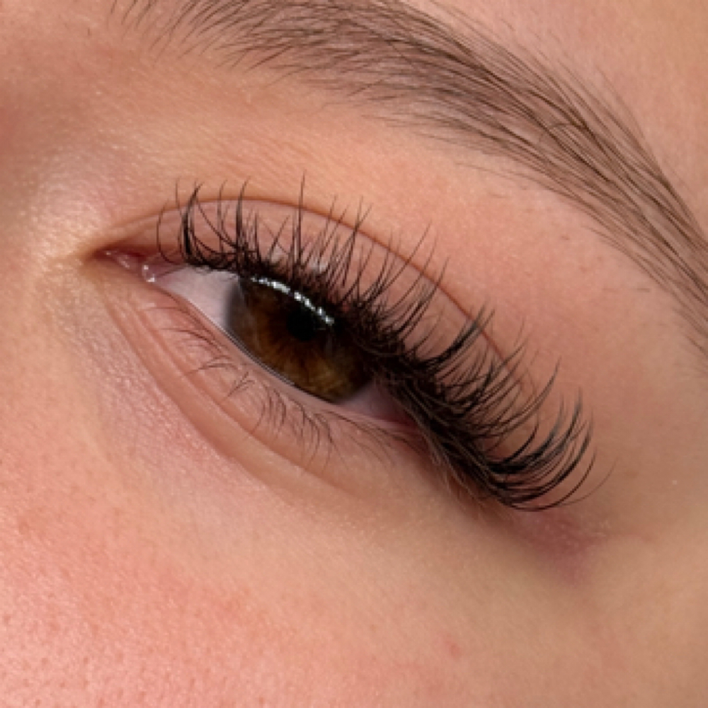 Custom Mini Fill at Villa Esthetics in Bryan, TX