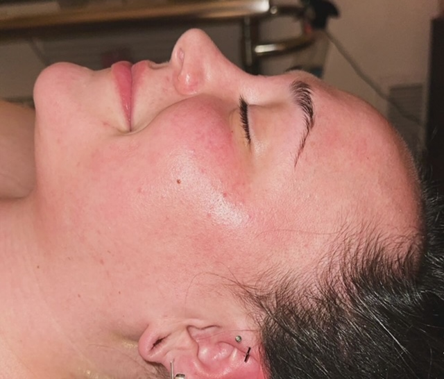 Fresh Face Facial
