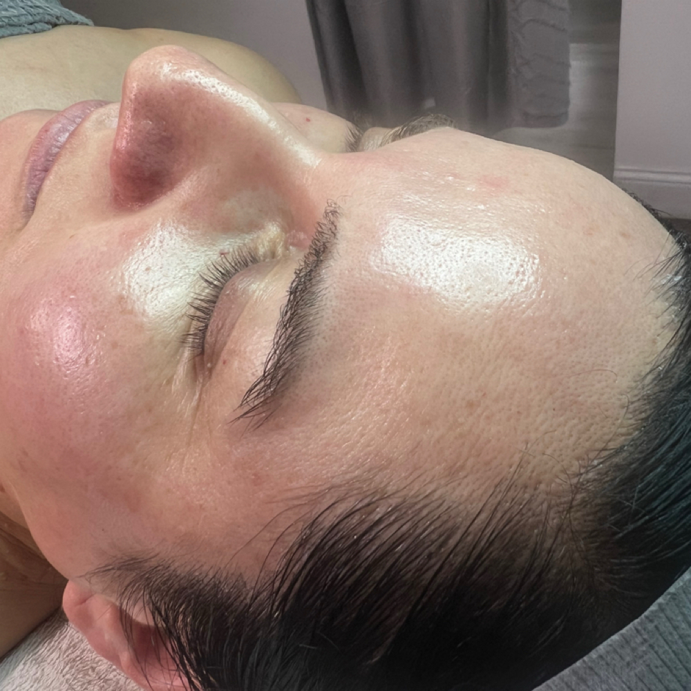 6 Month Basic Dermaplaning Package at The Este Lounge in Hanford, CA