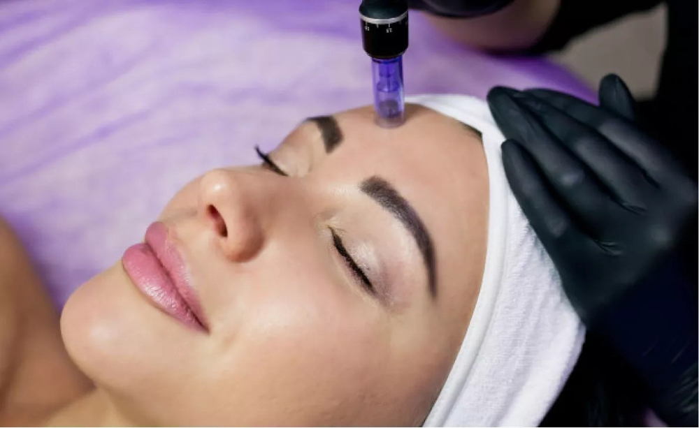 Micro-Needling Facial