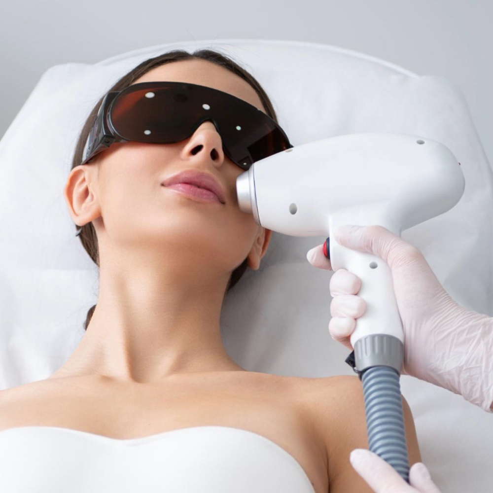 Laser Package Full Face (6) at La Belle Studio by Soraya in Woburn, MA