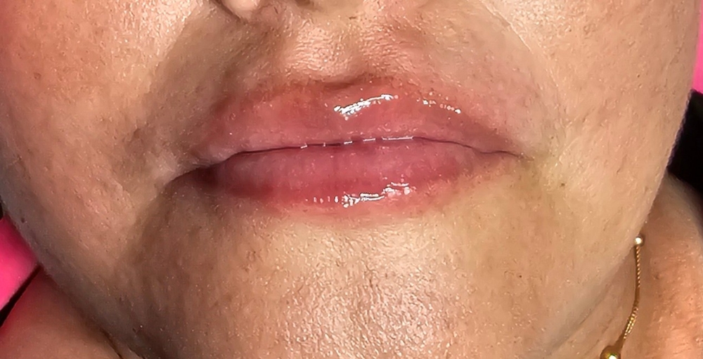 Hidratacion De Labios  0.5 (Serum)