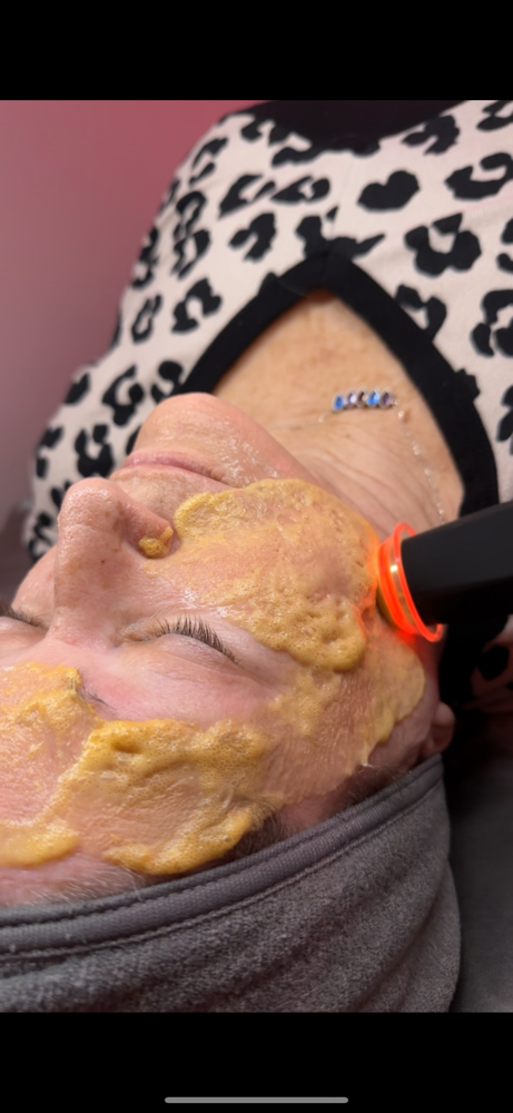Oxyglow Facial