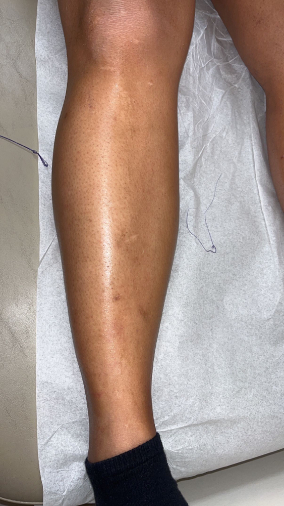 Lower Legs