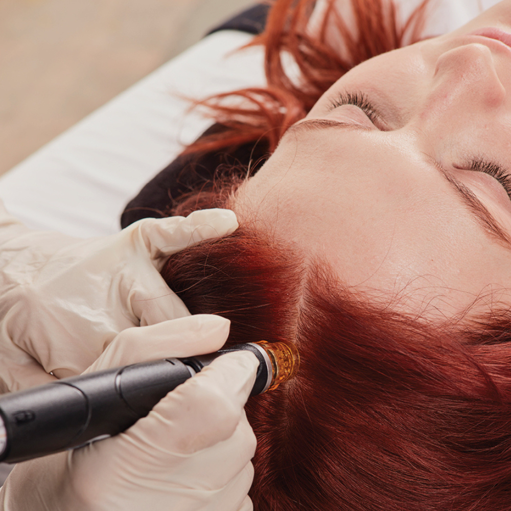 Scalp Treatment Hydrafacial at Elizabeth Young in Las Vegas, NV