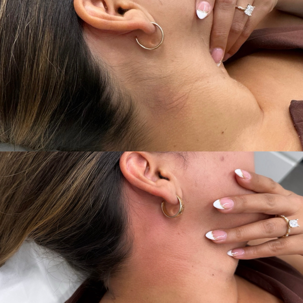 Neck Hair Wax at browsxdsg in Tempe, AZ