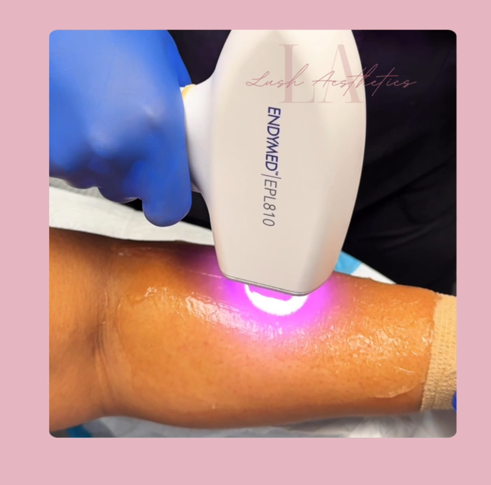 Laser Hair Removal-Medium Area